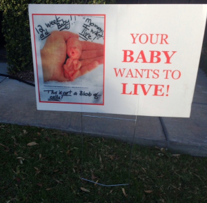 baby wants to liveFullSizeRender (5)