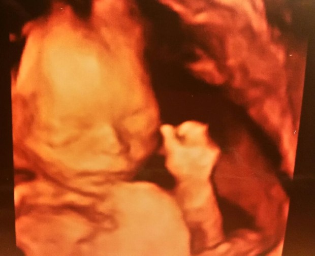 baby-john-brandys-baby